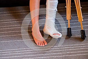 Girl with a broken leg .close-up of feet, one with a plaster bandage. foot splint for treatment of injuries from broken