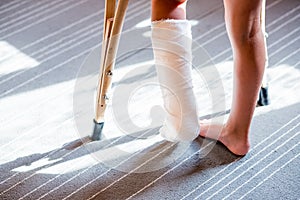 Girl with a broken leg .close-up of feet, one with a plaster bandage. foot splint for treatment of injuries from broken