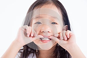 Girl child showing teeth with silver amalgam tooth sealant