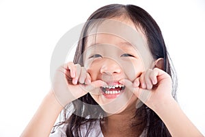Girl child showing teeth with silver amalgam tooth sealant