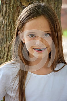 Girl with dental braces