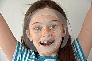 Girl with dental braces