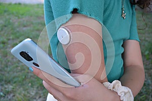 Girl with diabetes is reading the glucose levels from a white sensor on arm using mobile phone application.