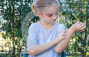 Girl with Eczema on Arms and Face