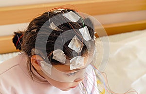 Girl with EEG electrodes attached to her head for medical test photo