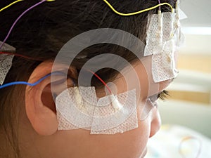 Girl with EEG electrodes attached to her head for medical test