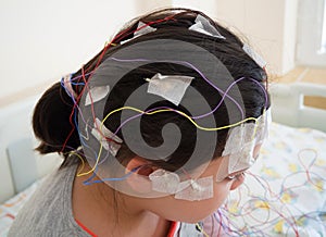 Girl with EEG electrodes attached to her head for medical test