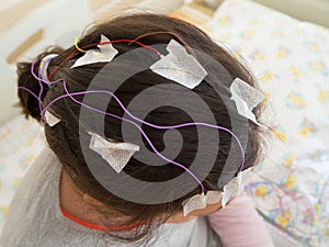 Girl with EEG electrodes attached to her head for medical test