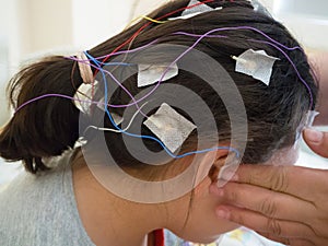 Girl with EEG electrodes attached to her head for medical test