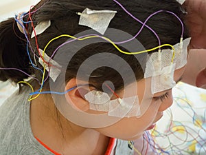 Girl with EEG electrodes attached to her head for medical test