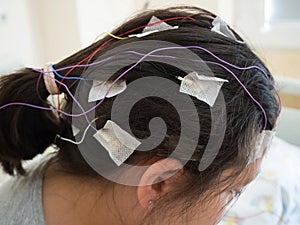 Girl with EEG electrodes attached to her head for medical test