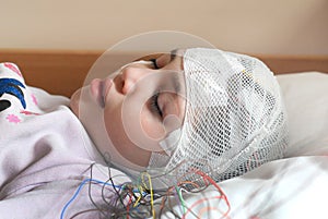 Girl with EEG electrodes attached to her head for medical test