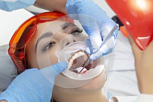 Girl on examination at dentist. treatment of carious tooth. the doctor uses a mirror on the handle and a boron machine