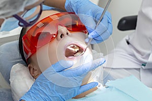 Girl on examination at dentist. treatment of carious tooth. the doctor uses a mirror on the handle and a boron machine