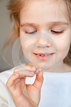 Girl with fallen milk tooth in hand. close up