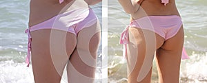 Girl figure in a swimsuit slimming cellulite he alth loss oversize before and after the diet fitness