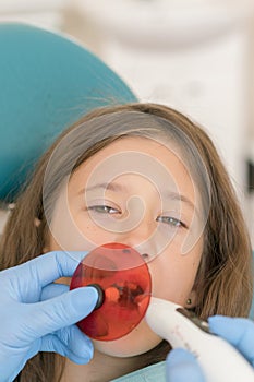 Girl getting dental filling treatment at molar tooth with ultraviolet technology. Image of little girl having her teeth
