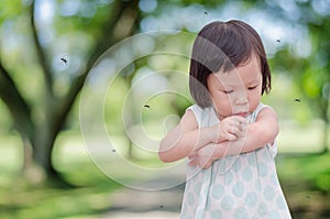 Girl has allergies with mosquitoes bite