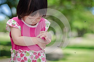 Girl has allergies with mosquitoes bite