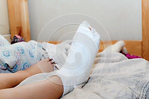 The girl has a broken leg. Woman resting at home in bed after medical treatment. Human leg in a cast on the bed