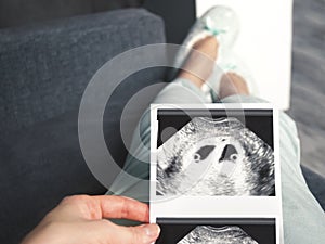 The girl is holding a snapshot of an ultrasound twin in the fourth week of pregnancy. First trimester. Selective focus