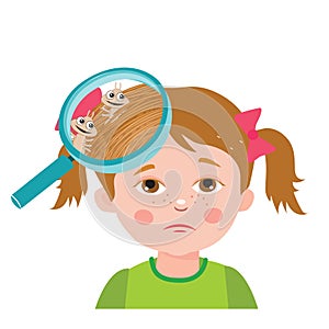 Girl with lice. Magnifying glass close up of a head. Vector illustration. Dirty head. Dirty hair. Infection.