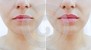 Girl lips before and after magnification