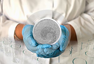 a girl in a medical gown and gloves holds a photo of candida albicans from a microscope in a round frame