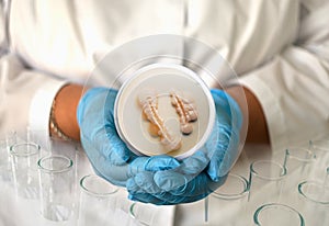 a girl in a medical gown and gloves holds a photo of candida albicans from a microscope in a round frame