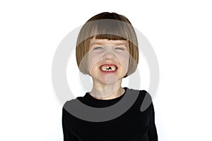 Girl with missing teeth smiling