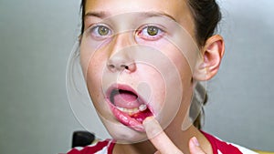 Girl opening mouth and pushing shaky baby tooth with tongue