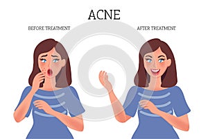 Girl with pimples on her face. Concept before and after acne treatment. Healthy skin. Vector graphics of a person`s appearance