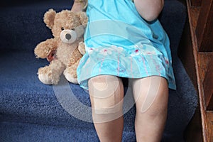 Girl with plaster on knee cuddling teddy photo