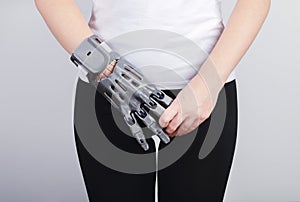 A girl with a prosthesis printed on a 3D printer holds the fingers of the prosthesis with her hand.