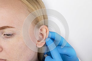 Darwin`s tubercle on the ear. The girl at the reception at the plastic surgeon, shows the auricle photo