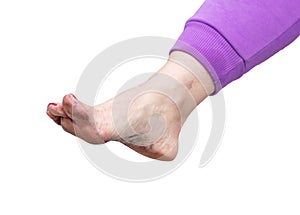 Girl& x27;s dirty foot isolated on white background
