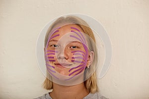 Girl's face with glued kinesiological tapes for lymphatic drainage