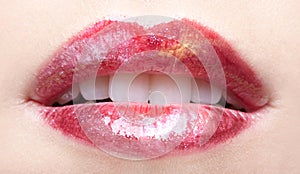 Girl's lips