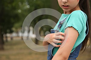 Girl scratching arm with insect bites in park, closeup. Space for text