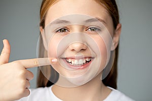 The girl smiles and shows her uneven teeth with a finger. Dental medicine and healthcare