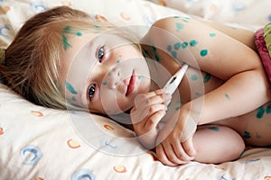 Girl suffers chickenpox