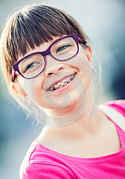 Girl. Teen. Pre teen. Girl with glasses. Girl with teeth braces. Young cute caucasian blond girl wearing teeth braces and glasses