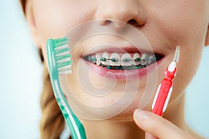 Girl with teeth braces using interdental and traditional brush