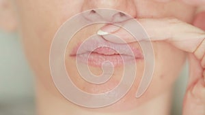 Girl touching sores on the lips. herpes. lip treatment