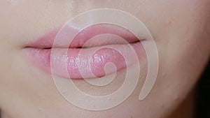 Girl touching sores on the lips. herpes. lip treatment, Young plump lips