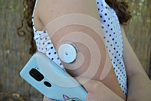 Girl use application on mobile phone to read sensor for continuous glucose monitoring on arm