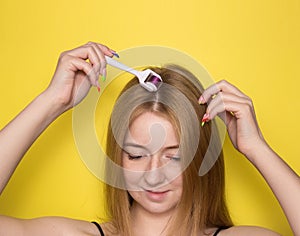Girl on a yellow background with a mesoroller. Mesotherapy for hair and scalp. Cosmetology, hair and body care