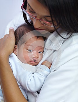 Giving comfort is key in her profession. Shot of a young female nurse holding a baby who has a cleft palate.