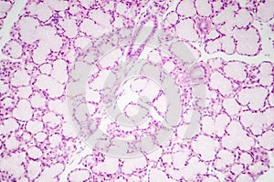 Glandular epithelium, micrograph photo