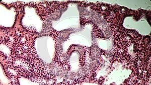 Glandular epithelium, microscopic photo of permanent preparation